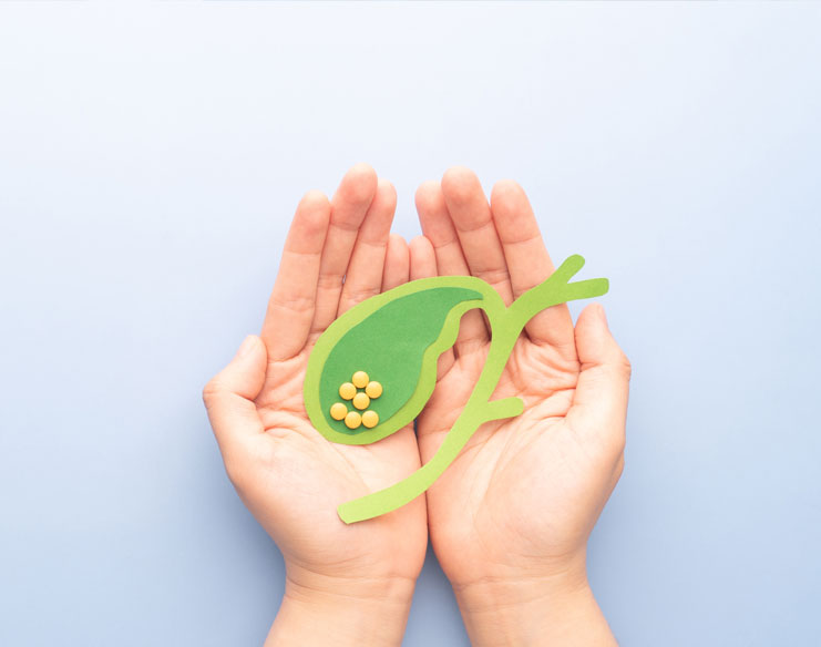 Is It Possible to Have Gallstones Without Symptoms?