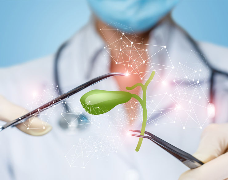 Understanding Gallbladder Cancer Stages